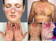 KGN Homoeo-Skin Treatment